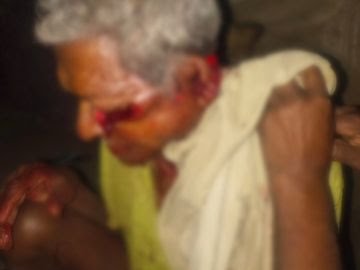 कोरबा में बुजुर्ग पर धारदार हथियार से हमला, आंख निकाली, हालत गंभीर; आरोपियों की तलाश में जुटी पुलिस