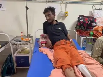 कोरबा: पुलिस पिटाई से युवक की जांघ की हड्डी टूटी, एसपी ने दिए जांच के आदेश