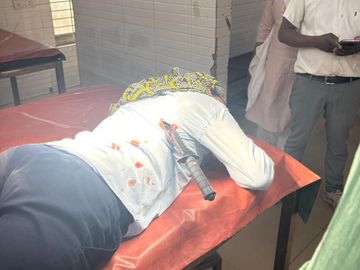 कोरबा: ड्यूटी जा रही नर्स पर सरेआम चाकू से हमला, आरोपियों की तलाश में जुटी पुलिस