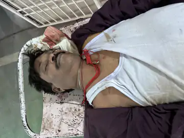छत्तीसगढ़:  तेज रफ्तार कार ने रेड सिग्नल पर खड़ी 2 बाइकों को मारी जोरदार टक्कर, नाबालिग समेत 2 लोगों की मौत