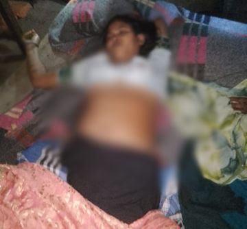 छत्तीसगढ़: पत्नी को करंट लगाकर मार-डाला, फिर डांस करता रहा पति; भाई बोला- बच्चा नहीं होने पर करता था टॉर्चर