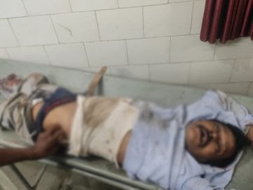 छत्तीसगढ़: ट्रक ने बाइक को मारी टक्कर, भाजपा बूथ अध्यक्ष की मौत; 20 मीटर तक घसीटा