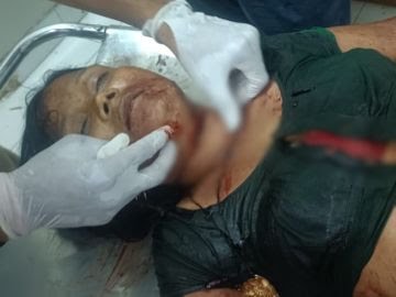 छत्तीसगढ़: मितानिन की ब्लेड से गला काटकर हत्या, आरोपी से पैसों को लेकर हुआ था विवाद; होटल में पति-बेटों का काम में बंटा रही थी हाथ