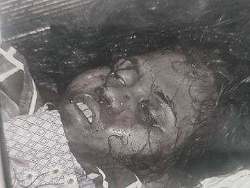 रायपुर: होटल में मिली लड़की की लाश, खून से लथपथ मिला युवक; मौके पर पहुंची पुलिस