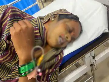 छत्तीसगढ़: कांवड़ यात्रा पर जा रही महिला पर एसिड अटैक, चेहरा जला, 2 बच्चे भी झुलसे; बात नहीं करने से नाराज था युवक